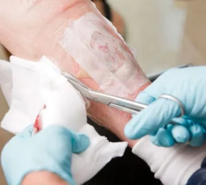 Wound-Care-Technology