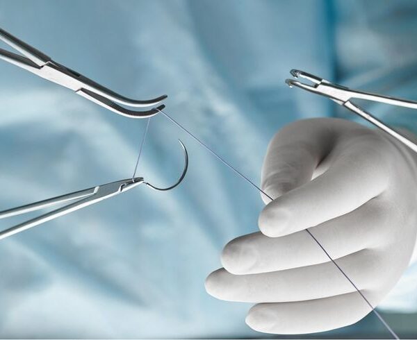 Types of Wound Closure and What They Mean for Faster Healing